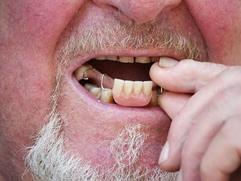 周公解梦梦见假牙掉了是什么意思 做梦梦到假