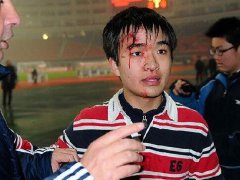 周公解梦梦见别人流血是什么意思