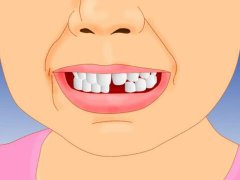 周公解梦孕妇梦见自己掉牙是什么意思