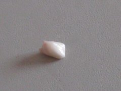 周公解梦梦见掉牙是怎么回事