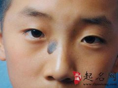 胎记的传说