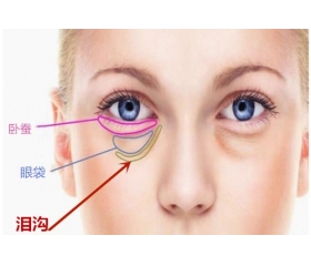 泪沟纹面相详解,有泪沟纹的人命运如何